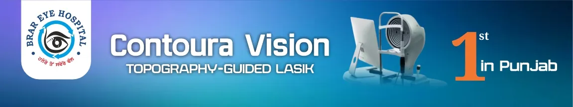 Cornea Services Banner